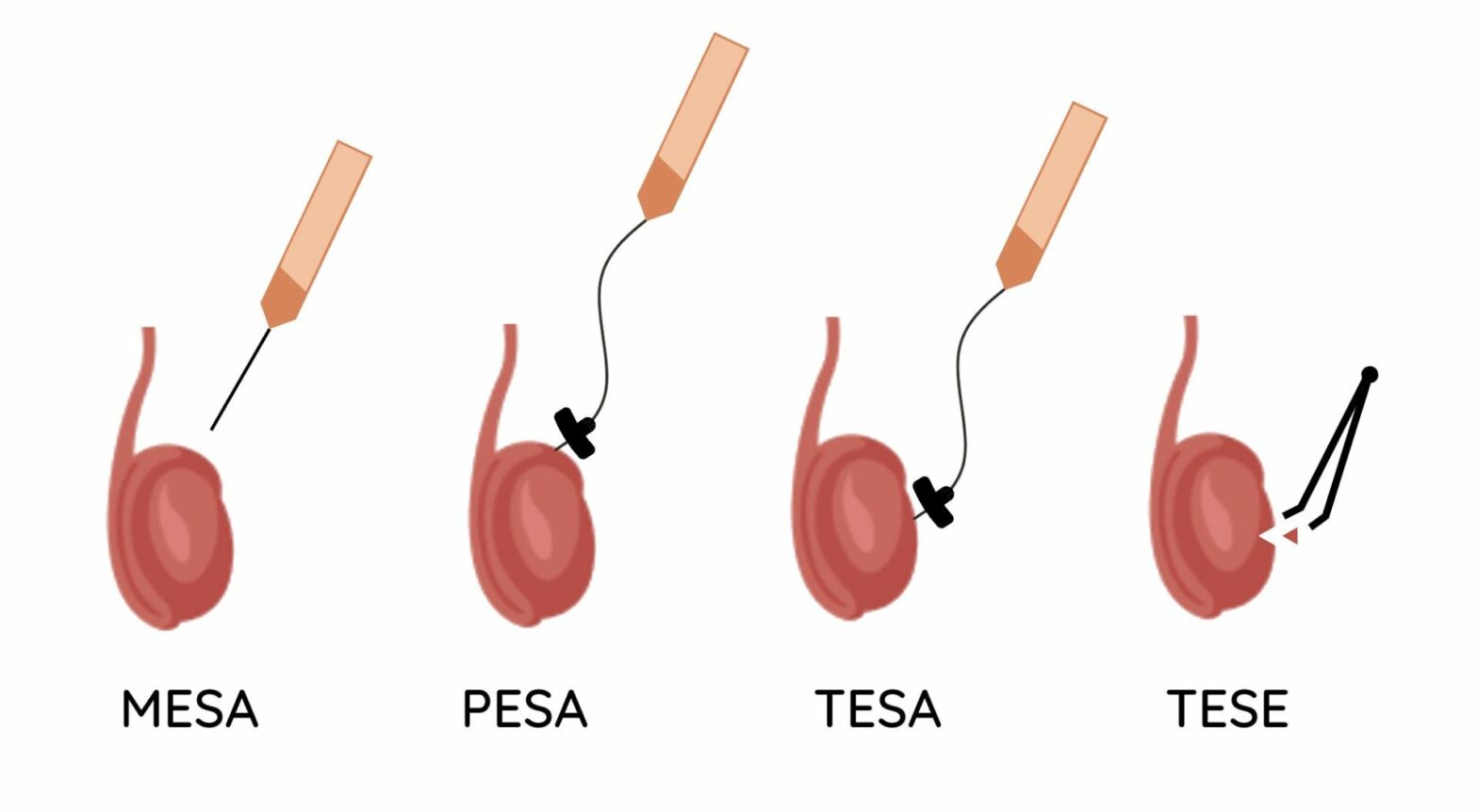 PESA, TESA & TESE 4 Screenshot 2023 05 24 at 11.00.14